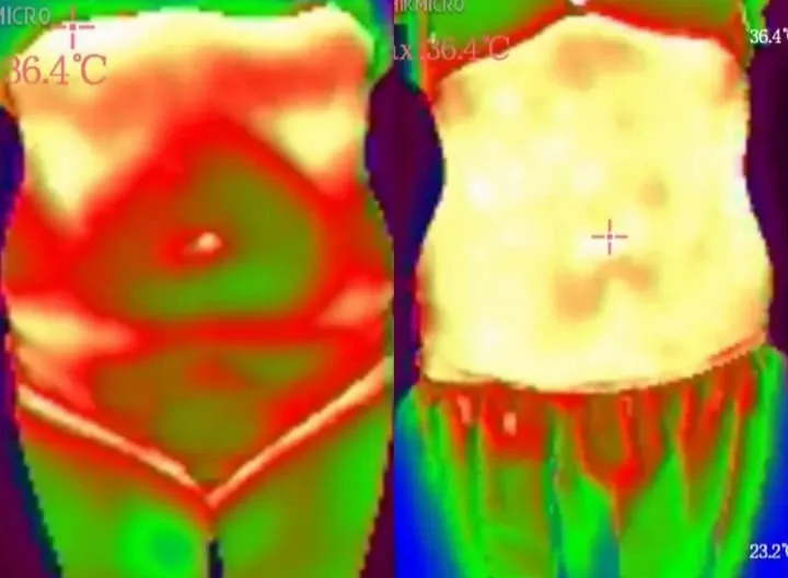 Mesoterapia Almeria Imagen